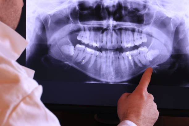 Best Tooth Infection Emergency Dentist  in Cedartown, GA